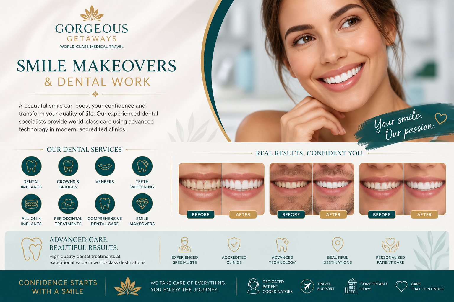 Smile Makeovers and Dental Work