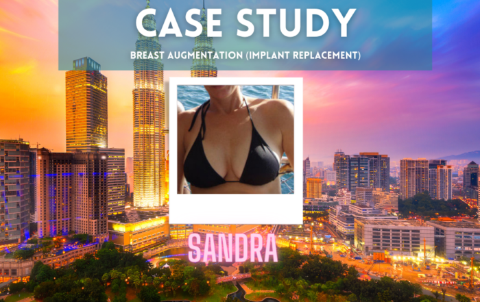 Gorgeous Getaways Patients-sandra