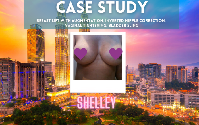 Gorgeous Getaways Patients-shelley