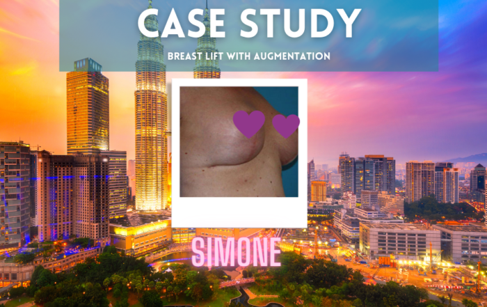 Gorgeous Getaways Patients-simone