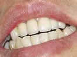 Dental Treatments Dental Treatments