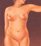 Liposuction Liposuction