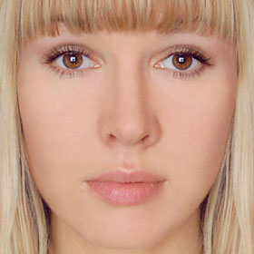 Botox and You Botox and You