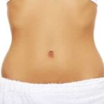 Belly Button (Navelplasty)-(YANH)