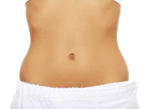 Belly Button (Navelplasty)-(YANH)