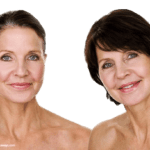 Face with Revisional Facial Contouring Surgery-(VG)