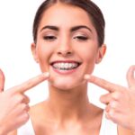 Orthodontics with Invisalign-(IDSC)