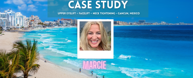 Case Study - MArcie