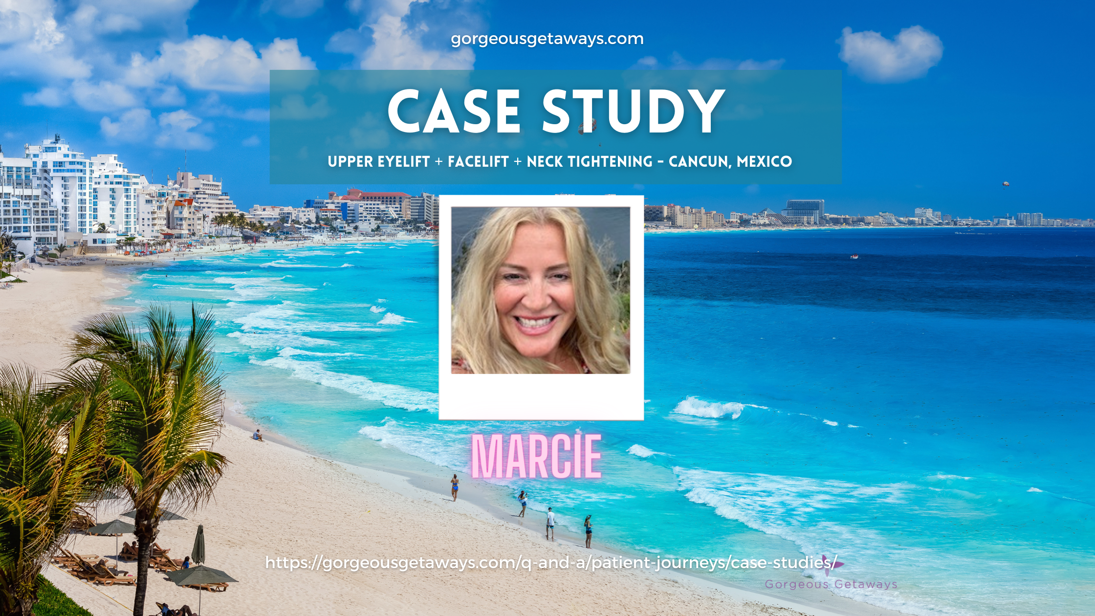 Case Study - MArcie