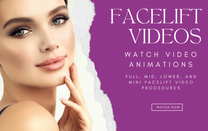 Facelift Videos