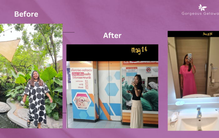 Gorgeous Getaways Bariatric Surgery Case Study: Kael Sangnam