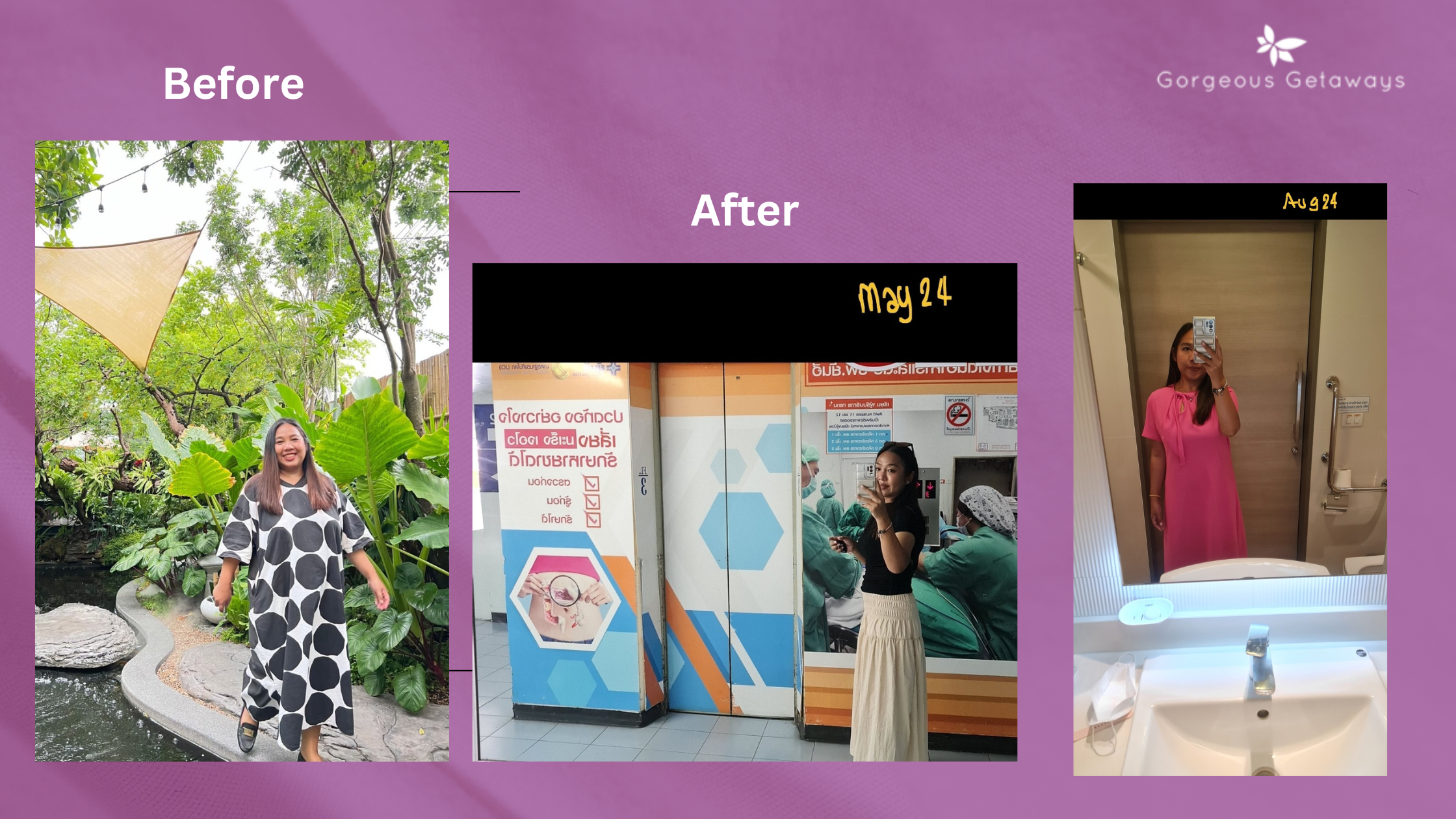 Gorgeous Getaways Bariatric Surgery Case Study: Kael Sangnam